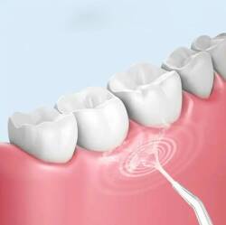 IRYGATOR DO ZĘBÓW BEZPRZEWODOWY DENTYSTYCZNY MOCNY 3TRYBY 8 KOŃCÓWEK